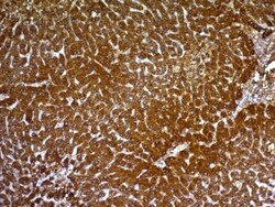 Hepatocyte Specific Antigen Antibody (HepPar1), Novus Biologicals 0.2mg;